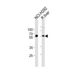 Methylcrotonoyl-CoA Carboxylase 2 (MCCC2) Antibody