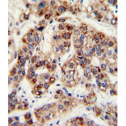 Ornithine Carbamoyltransferase, Mitochondrial (OTC) Antibody