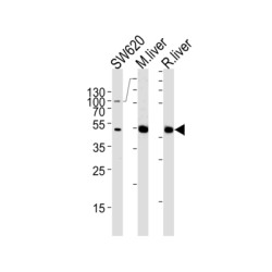 Ornithine Carbamoyltransferase, Mitochondrial (OTC) Antibody