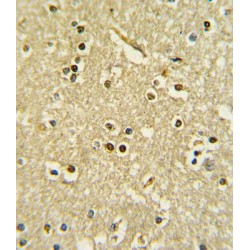 Paired Box Protein Pax-6 (PAX6) Antibody