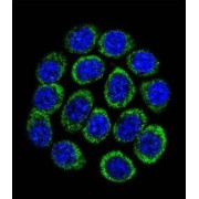 Tryptophan 5-Hydroxylase 1 (TPH1) Antibody