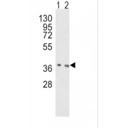 8-Oxoguanine DNA Glycosylase 1 (OGG1) Antibody