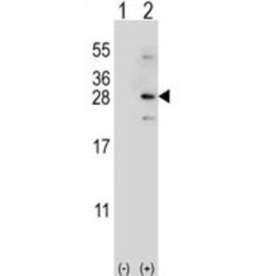 NADH:ubiquinone Oxidoreductase Subunit S4 (NDUFS4) Antibody