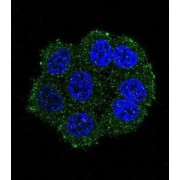 Transmembrane Protease, Serine 3 (TMPRSS3) Antibody