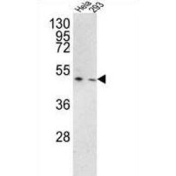 Transmembrane Protease, Serine 3 (TMPRSS3) Antibody