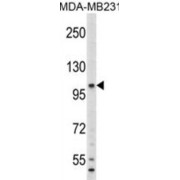 Western blot analysis of Human plasma (35 µg per lane) using Complement Component 6 (C6) Antibody (1/1000 dilution) and and HRP-conjugated Goat Anti-Rabbit secondary antibody (1/5000 dilution).