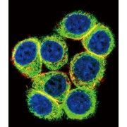 Cystathionine Beta-Synthase (CBS) Antibody