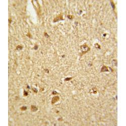 Cystathionine Beta-Synthase (CBS) Antibody