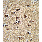 Protein Bicaudal C Homolog 1 (BICC1) Antibody
