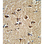 Protein Bicaudal C Homolog 1 (BICC1) Antibody