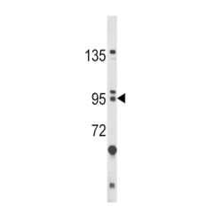 Protein Bicaudal C Homolog 1 (BICC1) Antibody