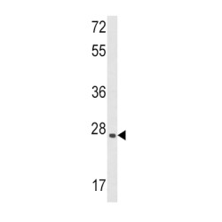 Leukemia Inhibitory Factor (LIF) Antibody
