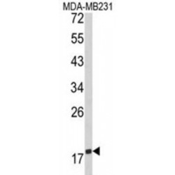 T-Cell-Specific Surface Glycoprotein CD28 (CD28) Antibody