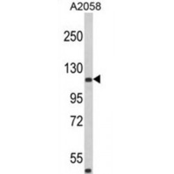 Rho GTPase Activating Protein 45 (HMHA1) Antibody