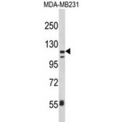 Integrin Alpha X / CD11C (ITGAX) Antibody