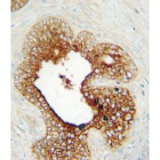 abx033099