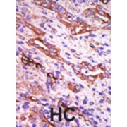Rhodopsin Kinase (GRK1) Antibody