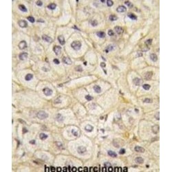Rhodopsin Kinase (GRK1) Antibody