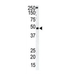 Rhodopsin Kinase (GRK1) Antibody
