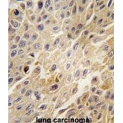 Adrenergic Receptor Beta Kinase 1 (ADRBK1) Antibody