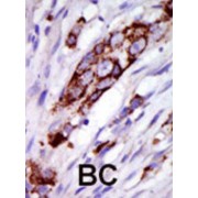 G Protein-Coupled Receptor Kinase 5 (GRK5) Antibody