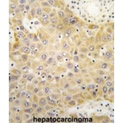 G Protein-Coupled Receptor Kinase 5 (GRK5) Antibody