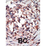 PKC beta 1 / 2 Antibody