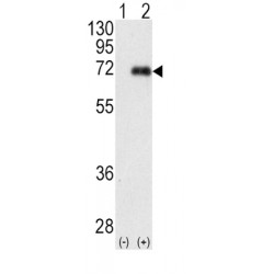 Protein Kinase C Iota Type (PRKCI) Antibody