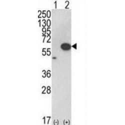 RAC-Alpha Serine/threonine-Protein Kinase (AKT1) Antibody