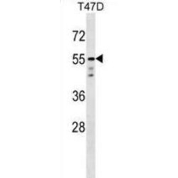 RAC-Alpha Serine/threonine-Protein Kinase (AKT1) Antibody