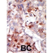 abx033131