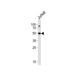 RAC-Gamma Serine/threonine-Protein Kinase (AKT3) Antibody