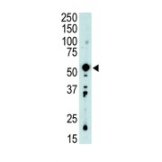 Pyruvate Dehydrogenase Kinase Isozyme 2 (PDK2) Antibody