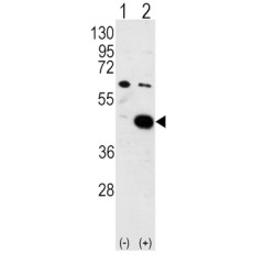 Pyruvate Dehydrogenase Kinase Isozyme 2 (PDK2) Antibody