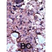 Pyruvate Kinase, Liver And RBC (PKLR) Antibody