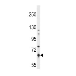 Pyruvate Kinase, Liver And RBC (PKLR) Antibody