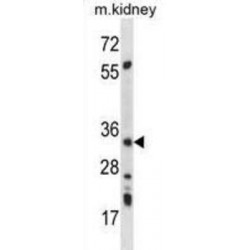 5'-AMP-Activated Protein Kinase Subunit Beta-2 (AMPK beta 2) Antibody