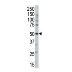 5'-AMP-Activated Protein Kinase Subunit Gamma-3 (PRKAG3) Antibody