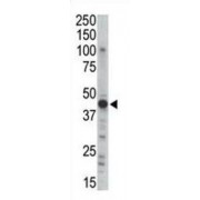 PKA 2 beta Antibody