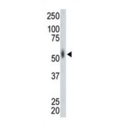 MAP Kinase-Interacting Serine/threonine-Protein Kinase 2 (MNK2) Antibody