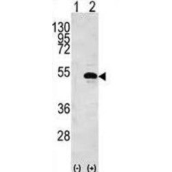 Creatine Kinase B-Type (CKB) Antibody