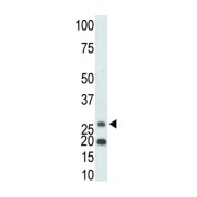 Ketohexokinase (KHK) Antibody