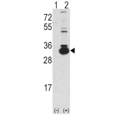 Ketohexokinase (KHK) Antibody