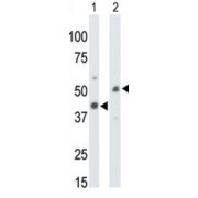 Creatine Kinase U-Type, Mitochondrial (CKMT1) Antibody