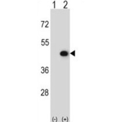 Creatine Kinase, Mitochondrial 2 (CKMT2) Antibody