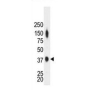 Creatine Kinase M-Type (CKM) Antibody
