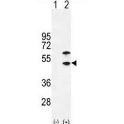 Creatine Kinase M-Type (CKM) Antibody