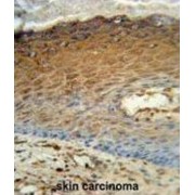 Adenylate Kinase 7 (AK7) Antibody