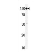 Serine/threonine-Protein Kinase TAO1 (TAOK1) Antibody
