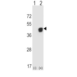 Phosphoglycerate Kinase 1 (PGK1) Antibody